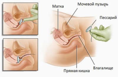 Иллюстрация 3 Иллюстрация 3