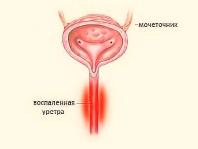 Иллюстрация 1 Иллюстрация 1