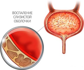Изображение 2 Изображение 2