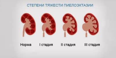 Иллюстрация 2 Иллюстрация 2