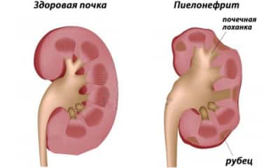 Картинка 1 Картинка 1