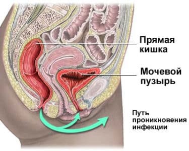 Картинка 3 Картинка 3