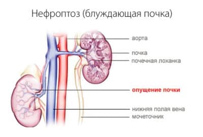 Картинка 1 Картинка 1