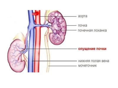 Картинка 6 Картинка 6