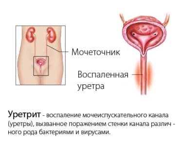 Иллюстрация 3 Иллюстрация 3