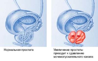 Изображение 1 Изображение 1